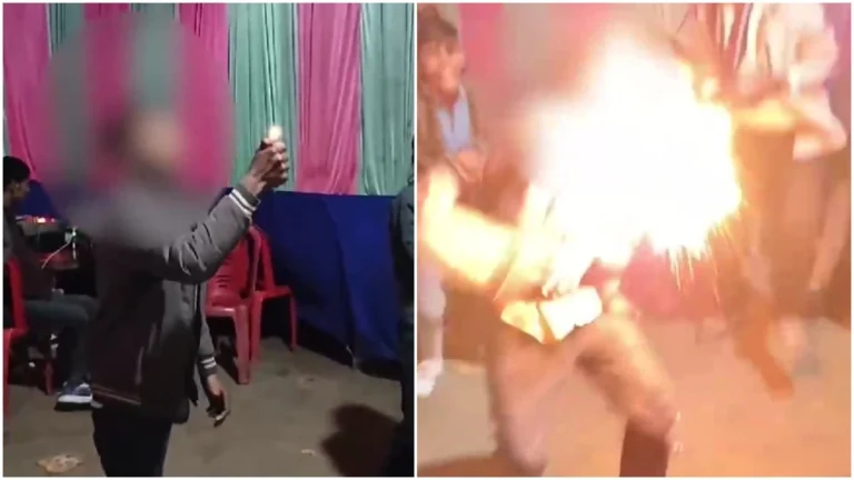 Youth’s Face Ignited During
